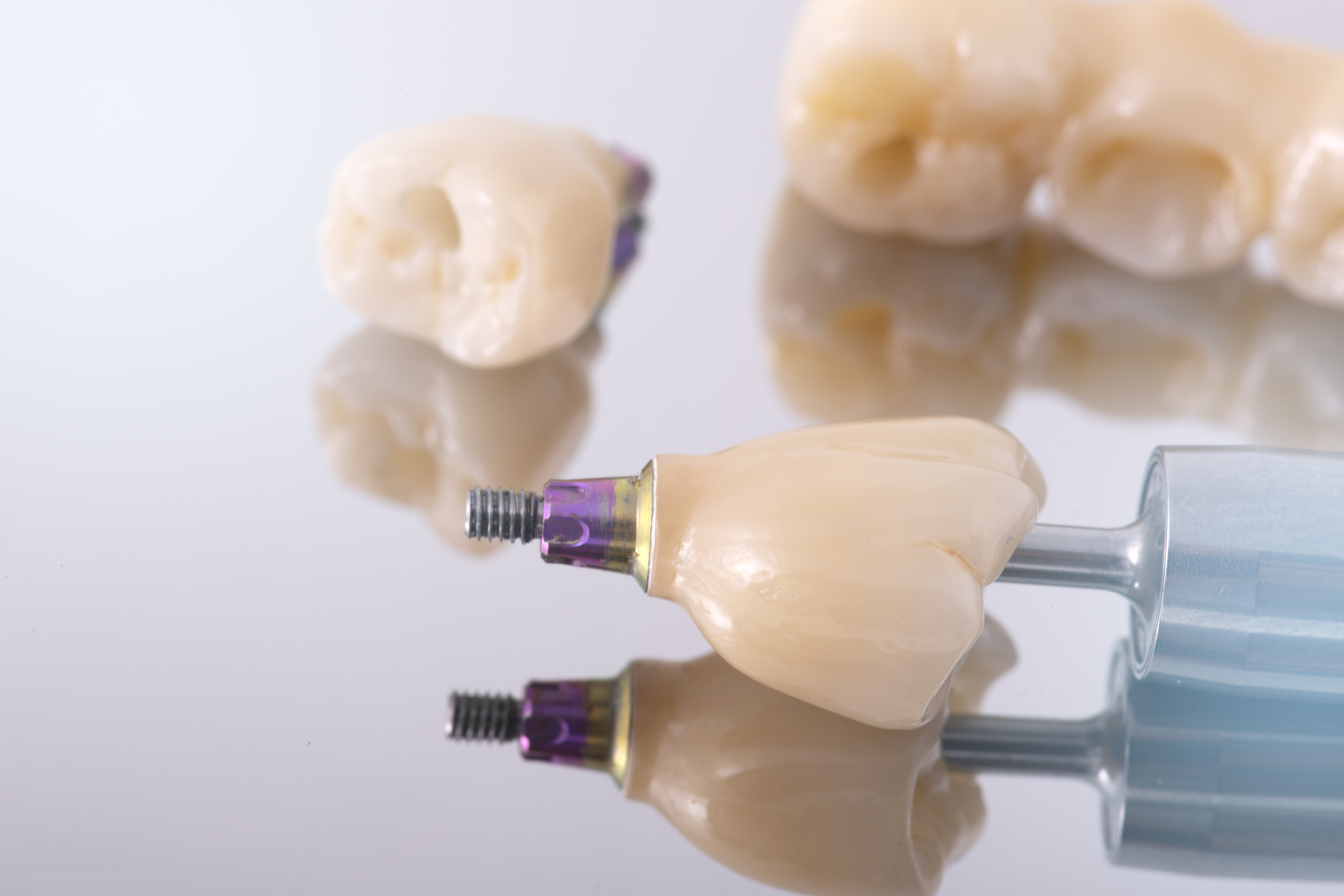 Tooth human implant. Dental concept. Ceramic human teeth or dentures.