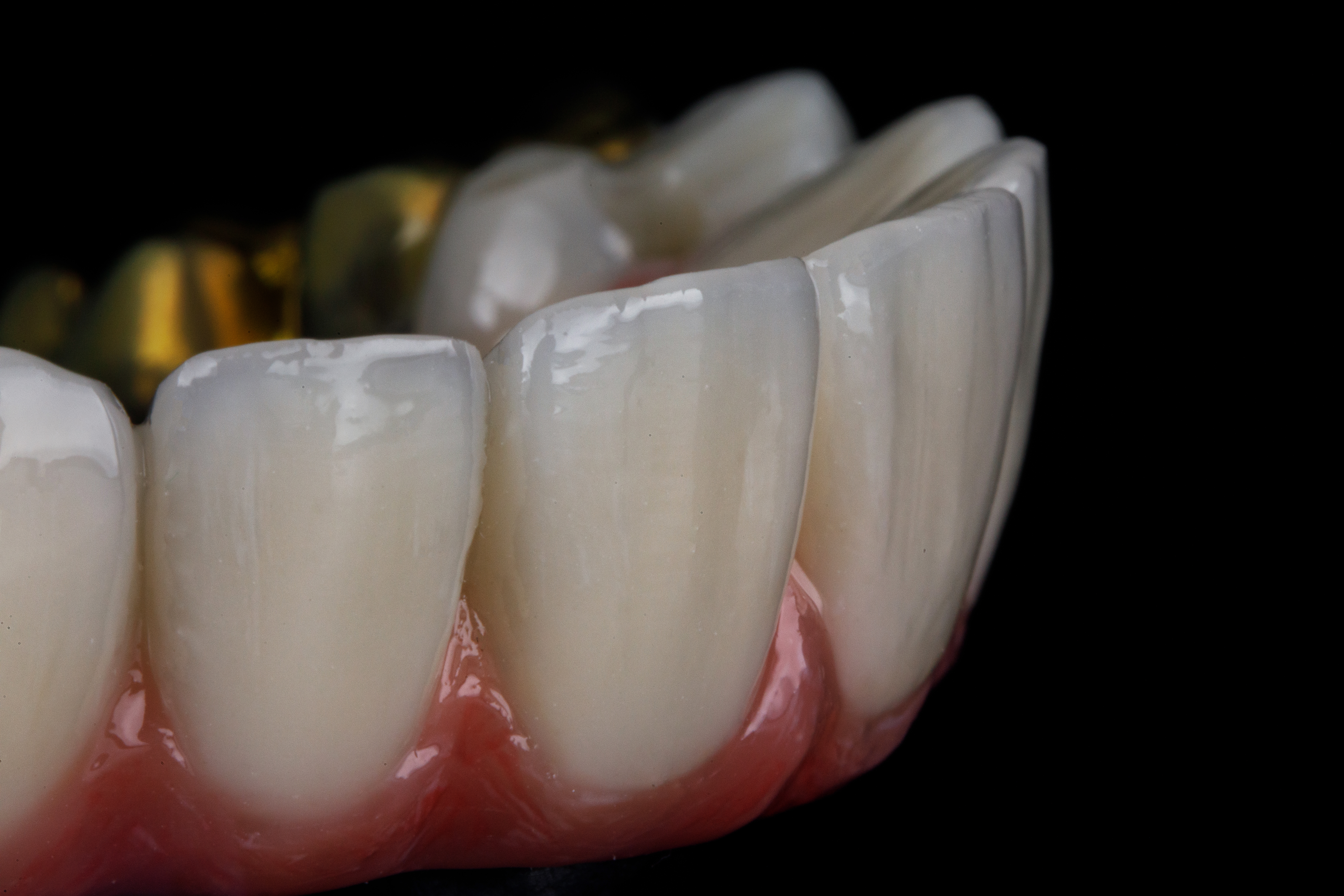 macro photo of the central incisors on a dental prosthesis